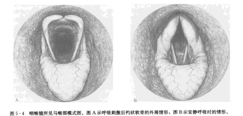 QQ截图20170429162321.png